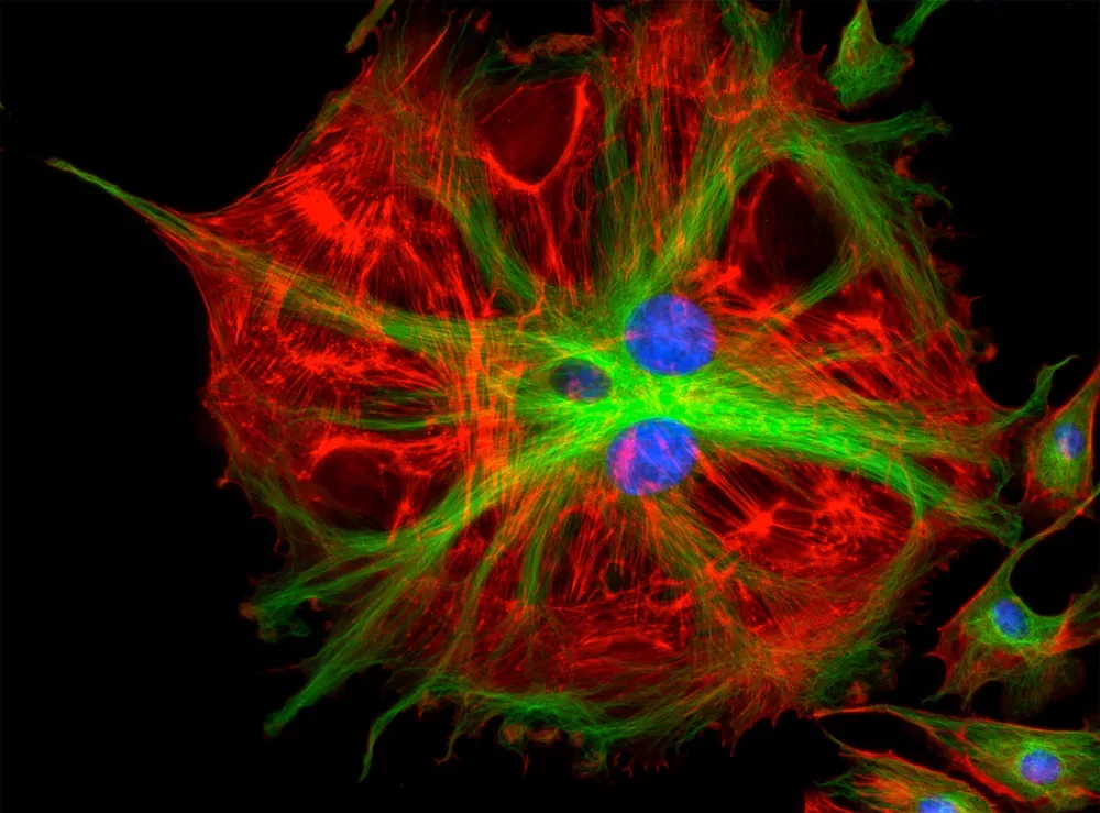 What is Mitochondrial dysfunction ? - XBrain